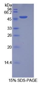 SDS-PAGE (ITGA5-6771H).jpg